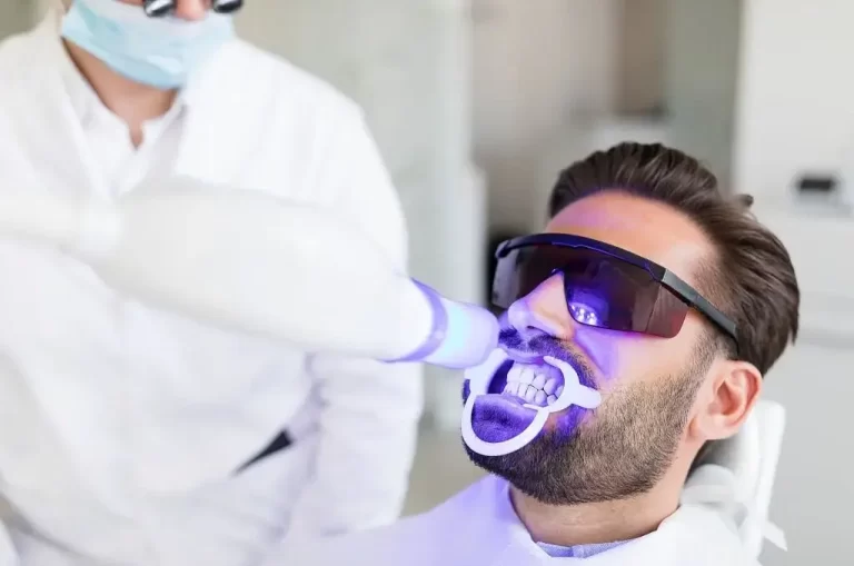 How Long Do White Spots on Teeth Last After Whitening?