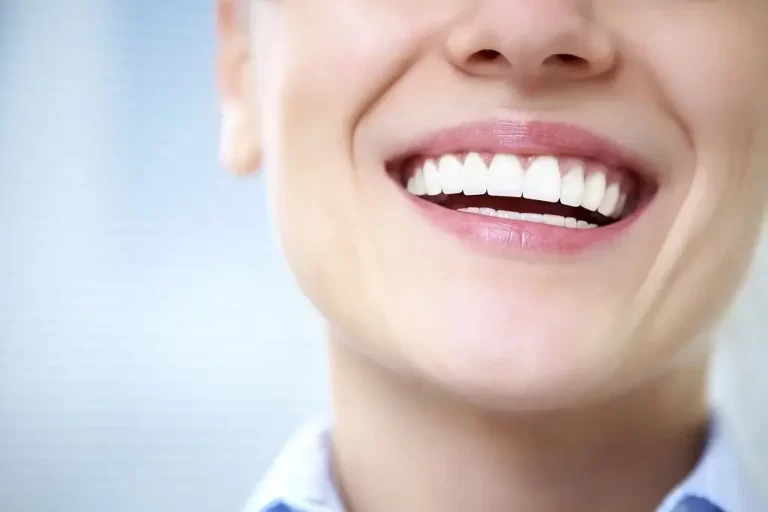 What Are These White Spots Veins on the Hard Palate Behind Front Teeth?