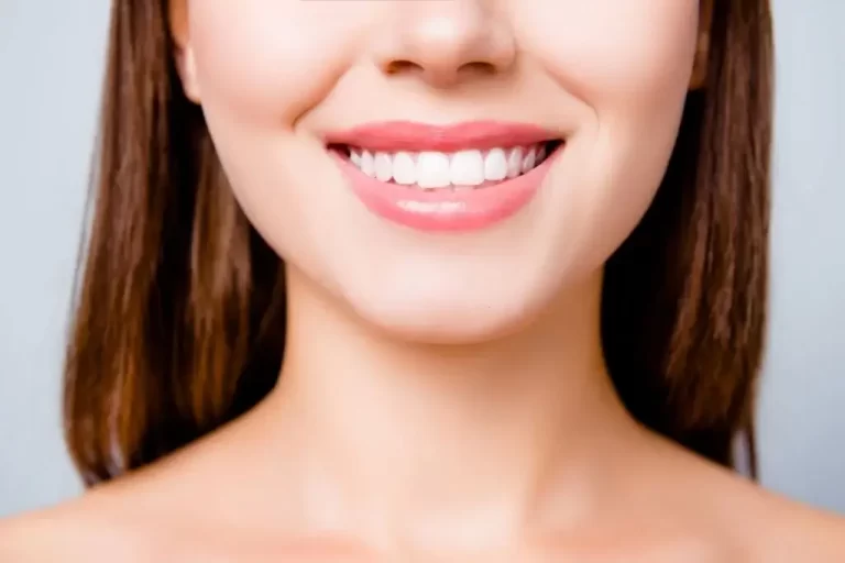 What Causes White Spots on My Teeth on My Front Teeth?