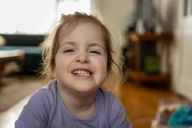 What Causes White Spots on Teeth Baby Teeth After a Fall?